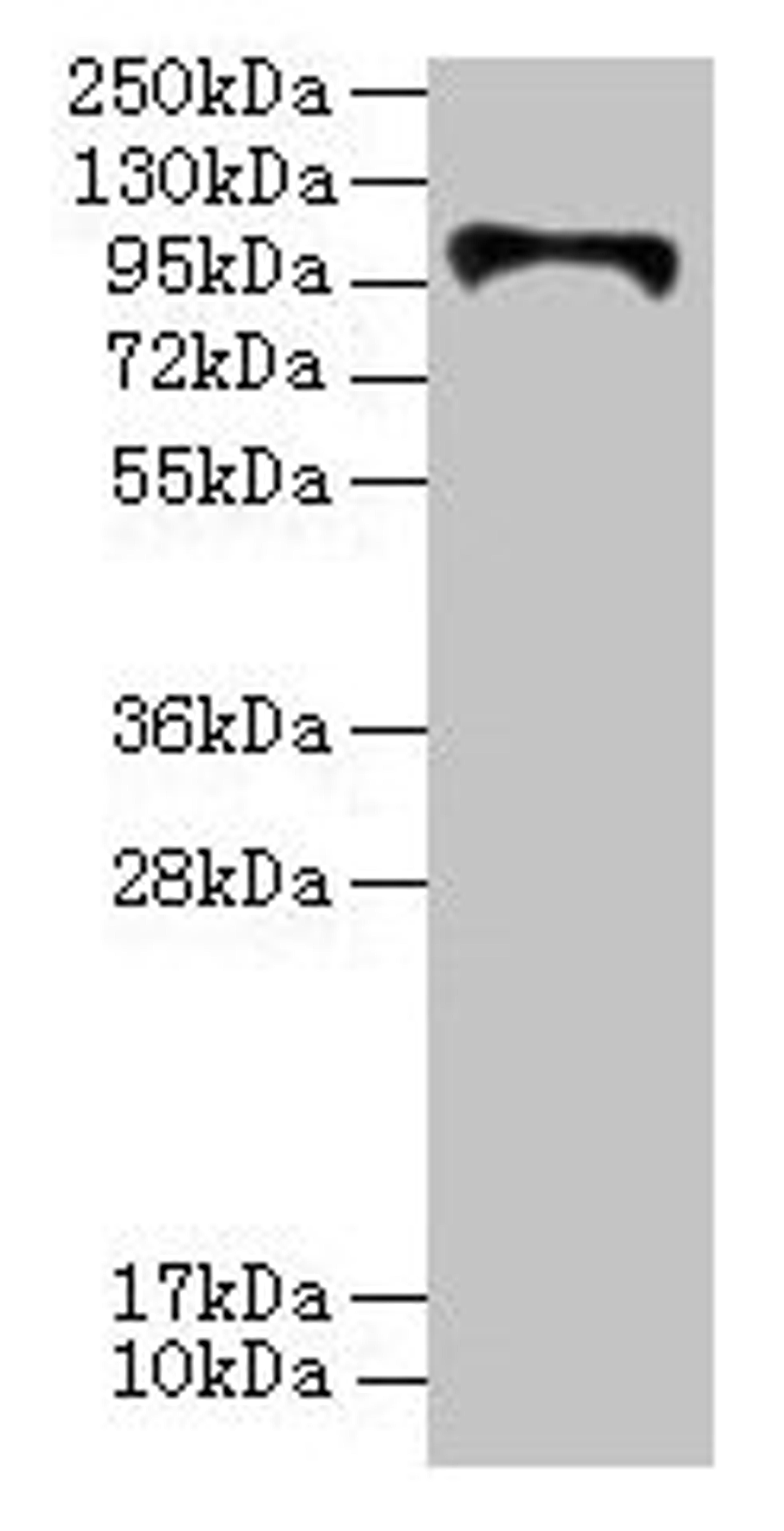 Western blot. All lanes: HKDC1 antibody at 4µg/ml + U87 whole cell lysate. Secondary. Goat polyclonal to rabbit IgG at 1/10000 dilution. Predicted band size: 103, 91, 83 kDa. Observed band size: 103 kDa