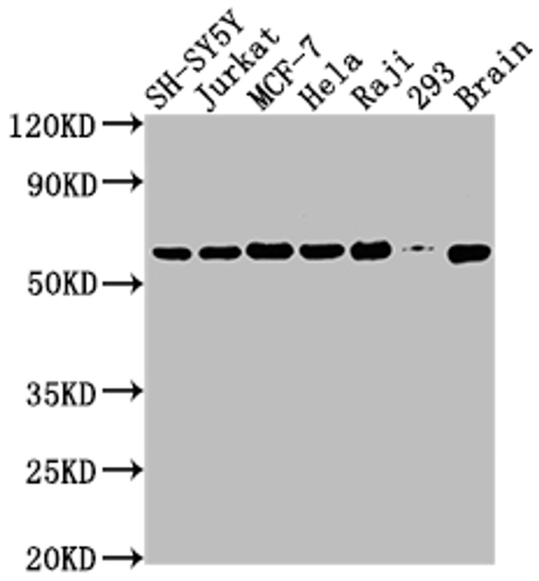 Western Blot. Positive WB detected in: SH-SY5Y whole cell lysate, Jurkat whole cell lysate, MCF-7 whole cell lysate, Hela whole cell lysate, Raji whole cell lysate, 293 whole cell lysate, Mouse brain tissue. All lanes: PKM antibody at 1:2000. Secondary. Goat polyclonal to rabbit IgG at 1/50000 dilution. Predicted band size: 58, 59, 57 kDa. Observed band size: 58 kDa. 