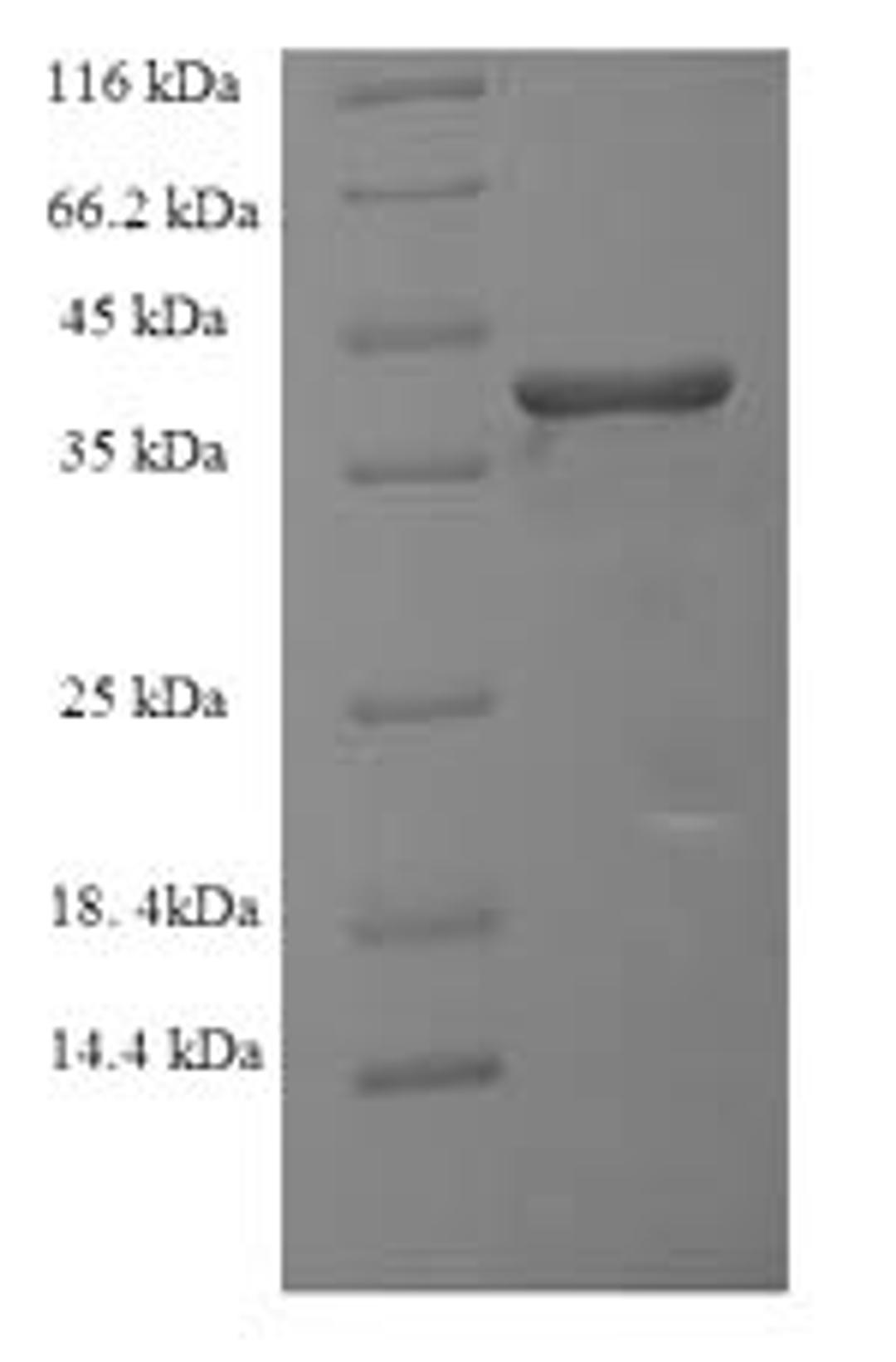 (Tris-Glycine gel) Discontinuous SDS-PAGE (reduced) with 5% enrichment gel and 15% separation gel.