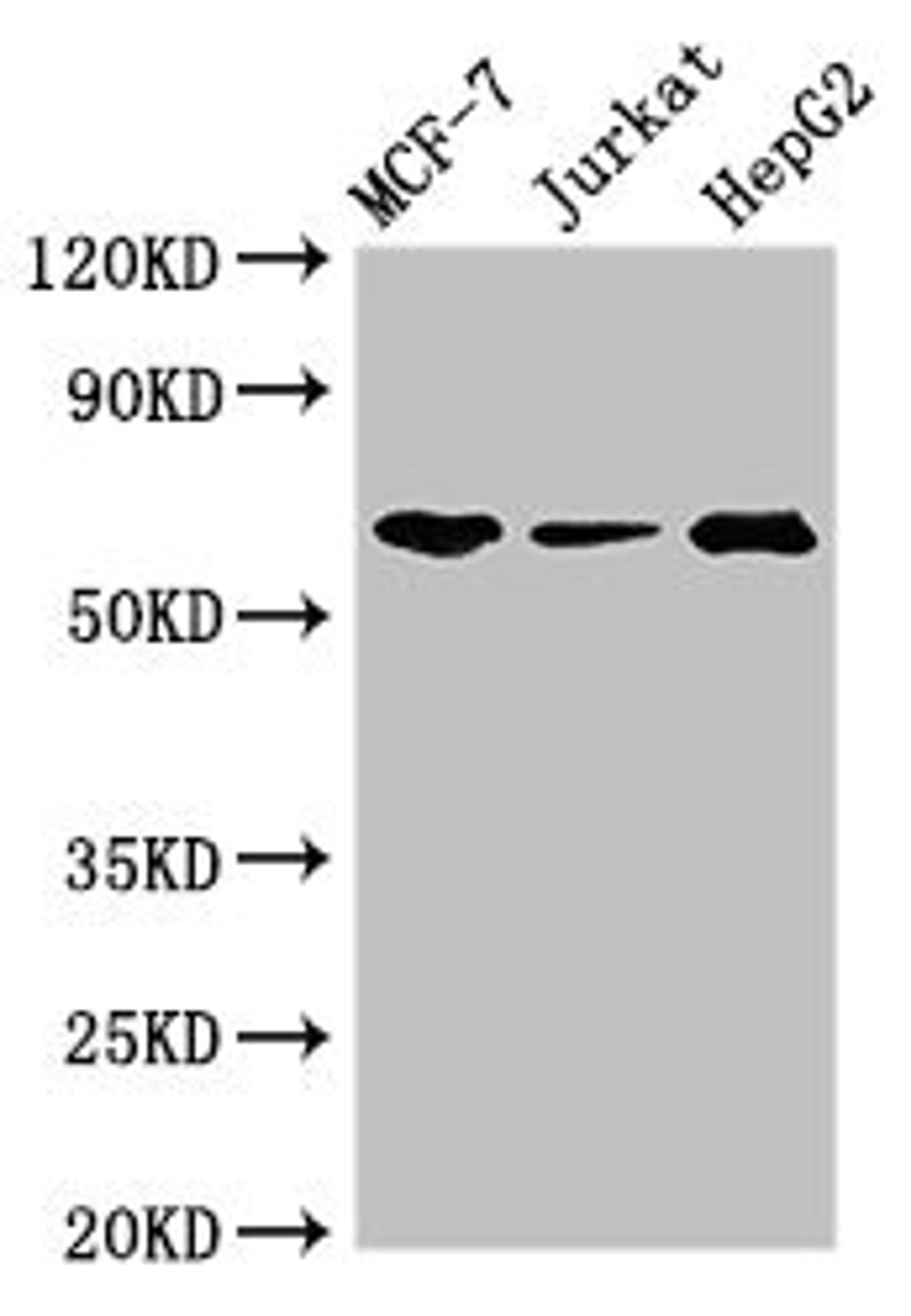 Western Blot. Positive WB detected in: MCF-7 whole cell lysate, Jurkat whole cell lysate, HepG2 whole cell lysate. All lanes: SHOC2 antibody at 3ug/ml. Secondary. Goat polyclonal to rabbit IgG at 1/50000 dilution. Predicted band size: 65, 60 kDa. Observed band size: 65 kDa. 