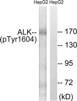 Western blot analysis of extracts from HepG2 cells, using ALK (Phospho-Tyr1604) antibody. The lane on the right is treated with the synthesized peptide.