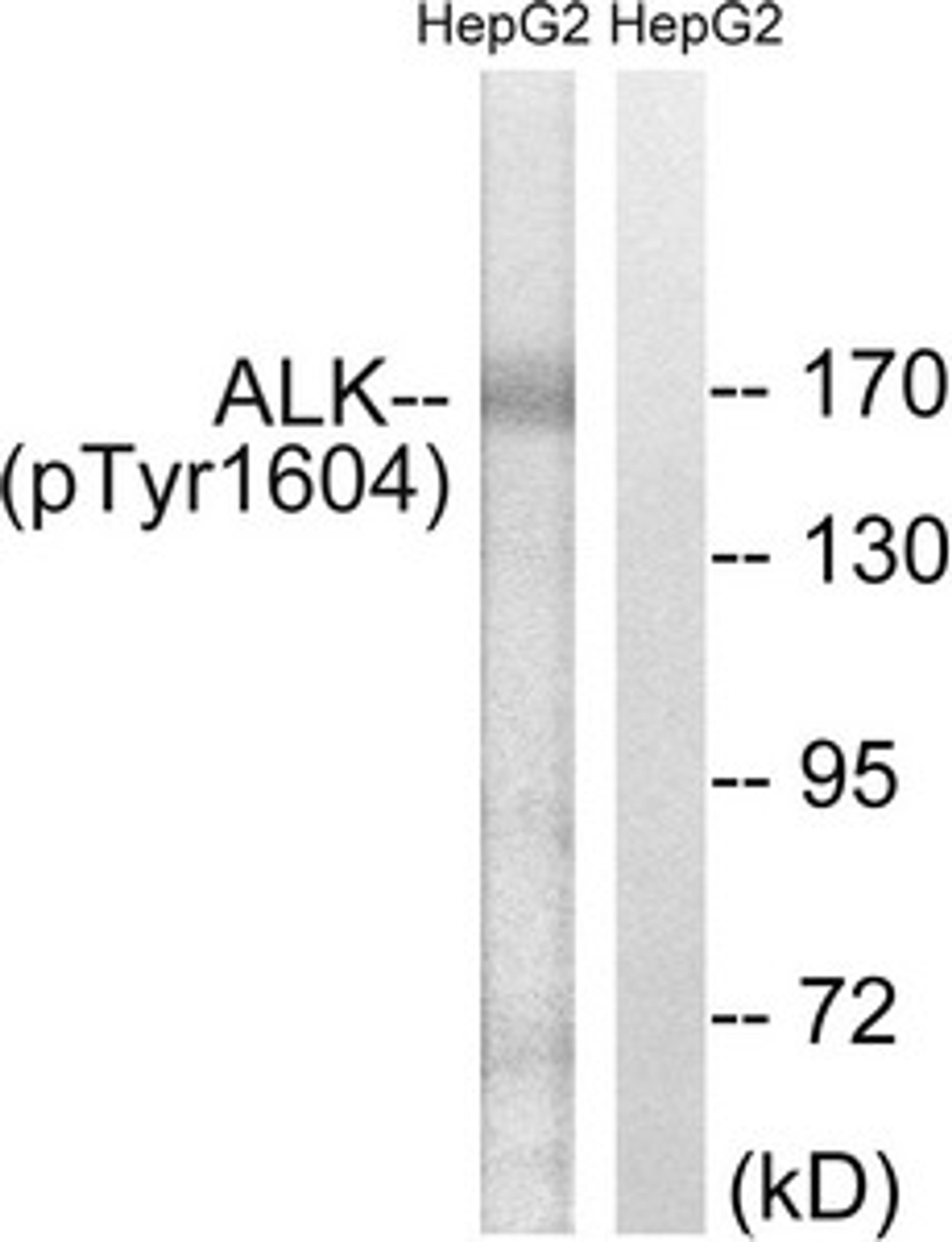 Western blot analysis of extracts from HepG2 cells, using ALK (Phospho-Tyr1604) antibody. The lane on the right is treated with the synthesized peptide.