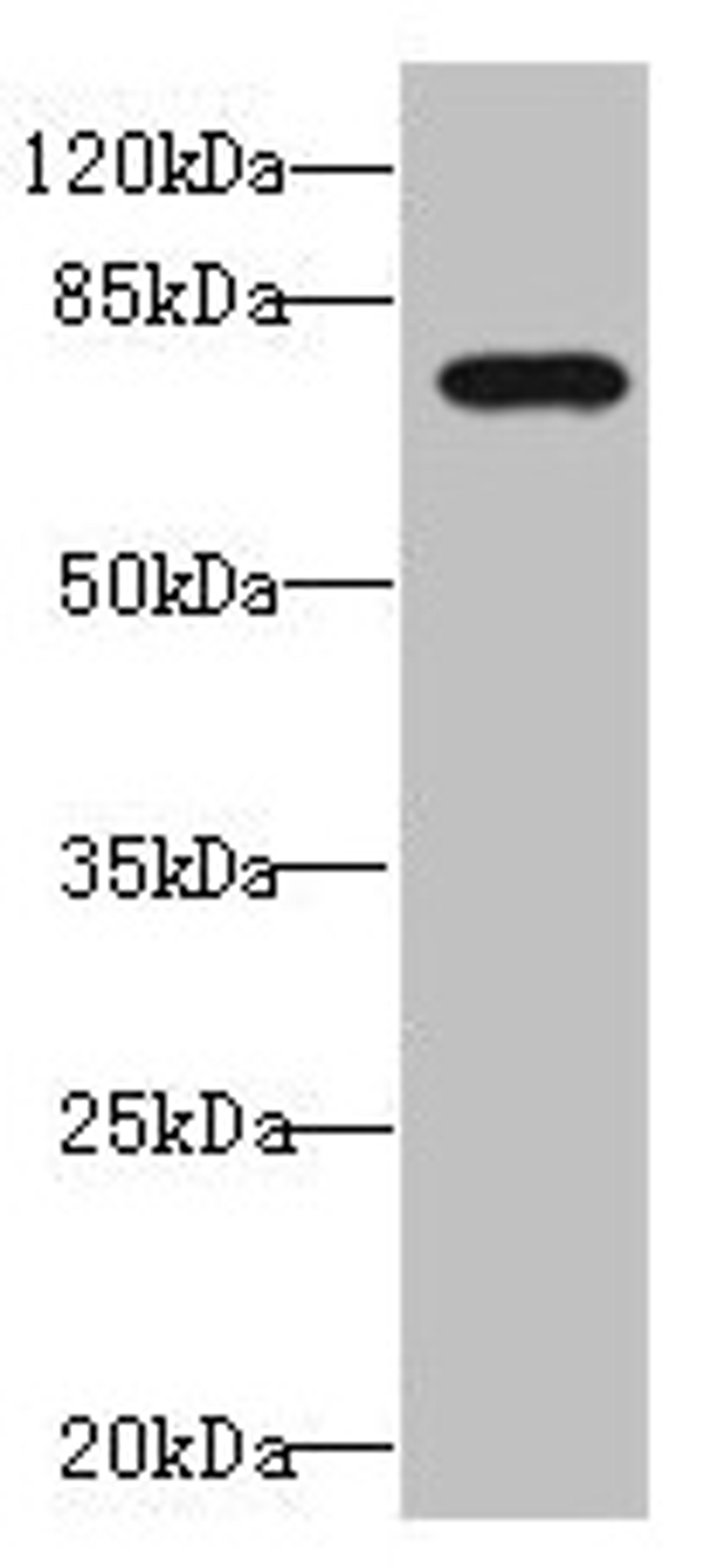 Western blot. All lanes: DUSP16 antibody at 1.69µg/ml + 293T whole cell lysate. Secondary. Goat polyclonal to rabbit IgG at 1/10000 dilution. Predicted band size: 74, 17 kDa. Observed band size: 74 kDa