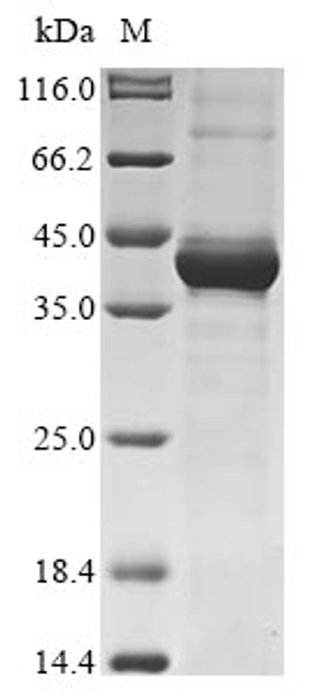 (Tris-Glycine gel) Discontinuous SDS-PAGE (reduced) with 5% enrichment gel and 15% separation gel.