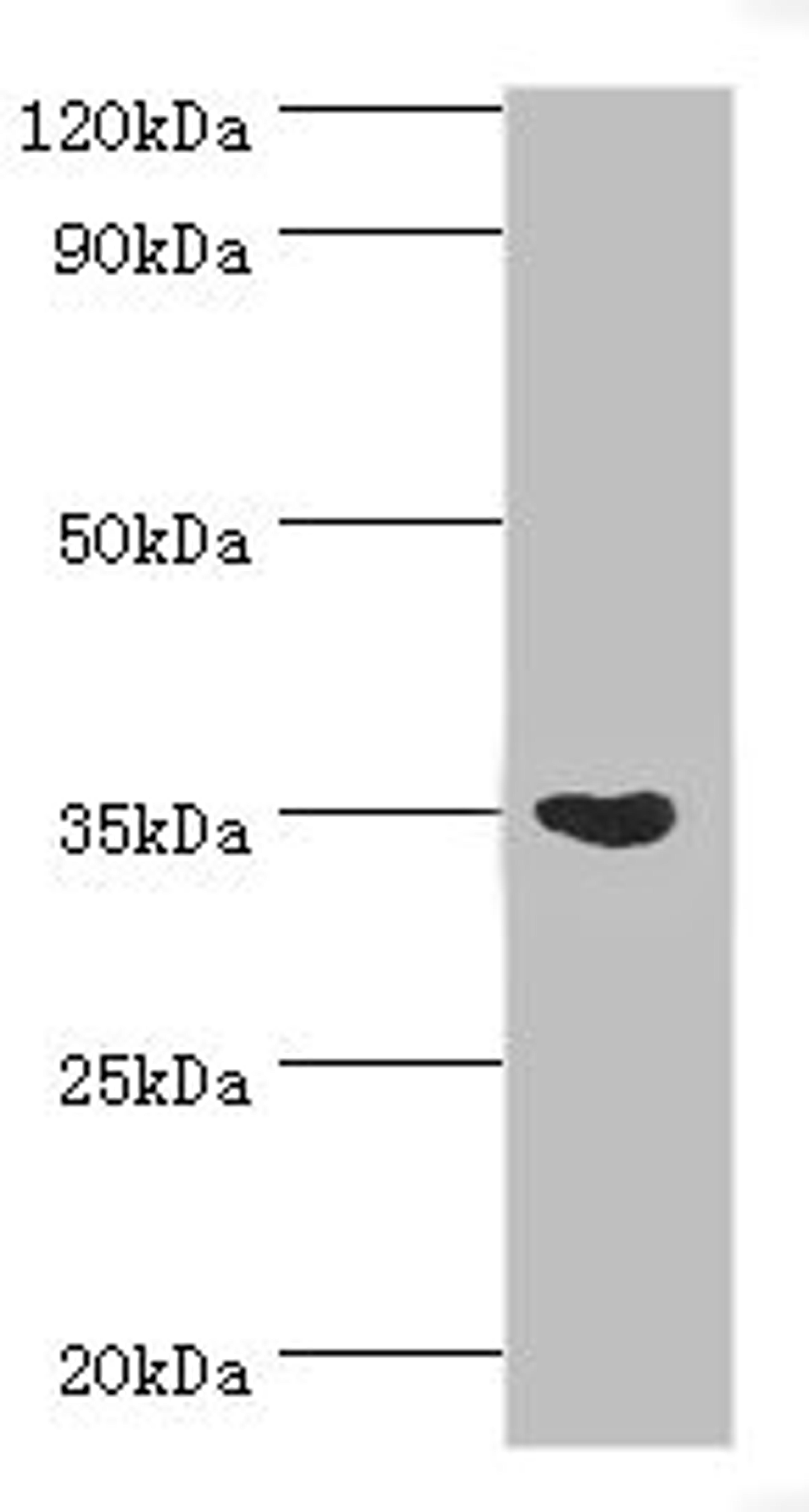 Western blot. All lanes: Arginase-1 antibody at 3ug/ml + Mouse liver tissue. Secondary. Goat polyclonal to rabbit IgG at 1/10000 dilution. Predicted band size: 35, 36, 26 kDa. Observed band size: 35 kDa. 