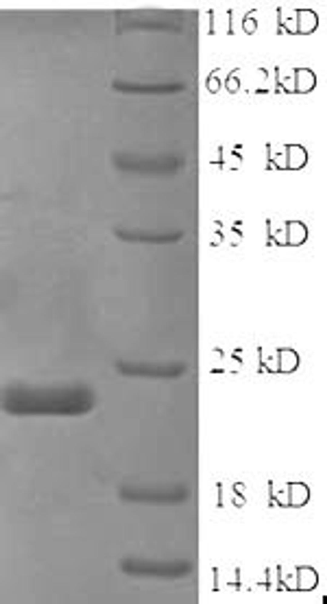 (Tris-Glycine gel) Discontinuous SDS-PAGE (reduced) with 5% enrichment gel and 15% separation gel.