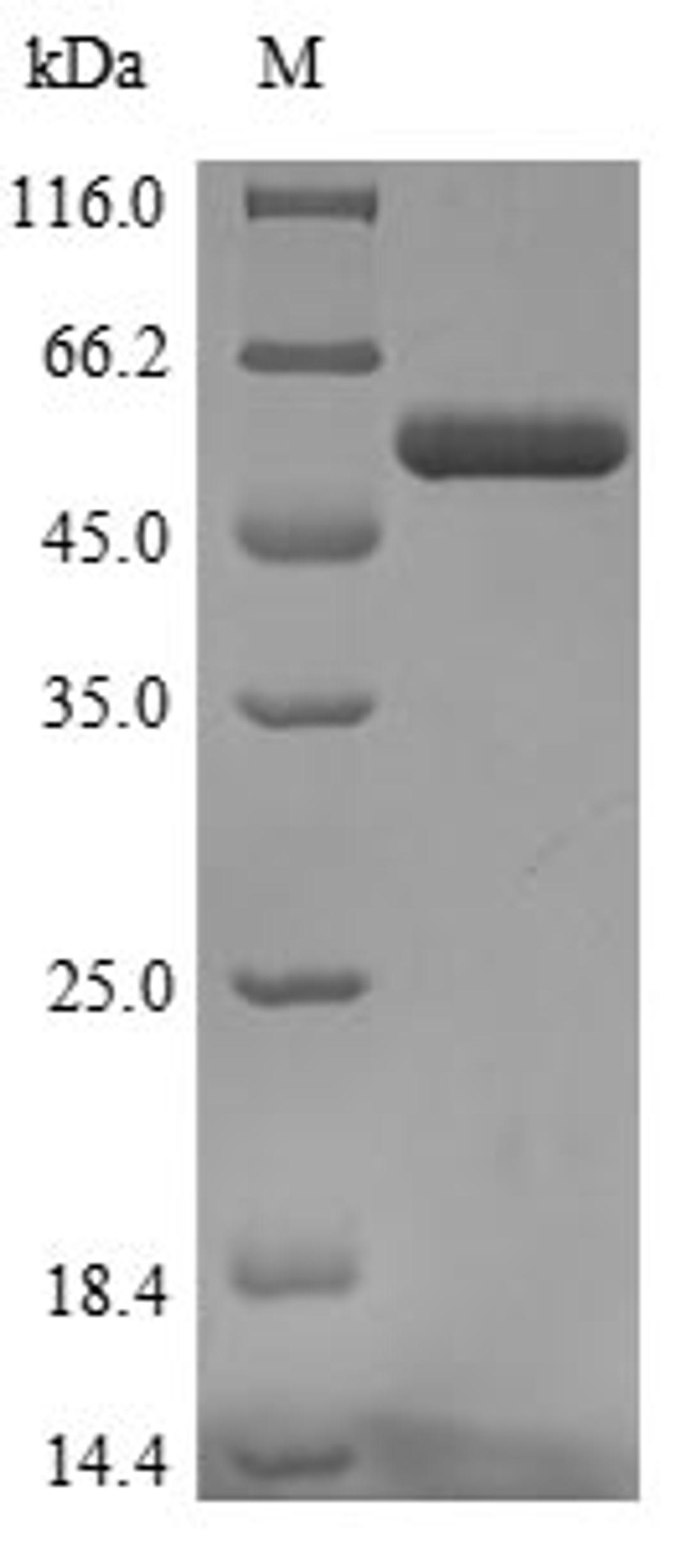 (Tris-Glycine gel) Discontinuous SDS-PAGE (reduced) with 5% enrichment gel and 15% separation gel.