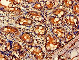 Immunohistochemistry of paraffin-embedded human small intestine tissue using CSB-PA00929A0Rb at dilution of 1:100