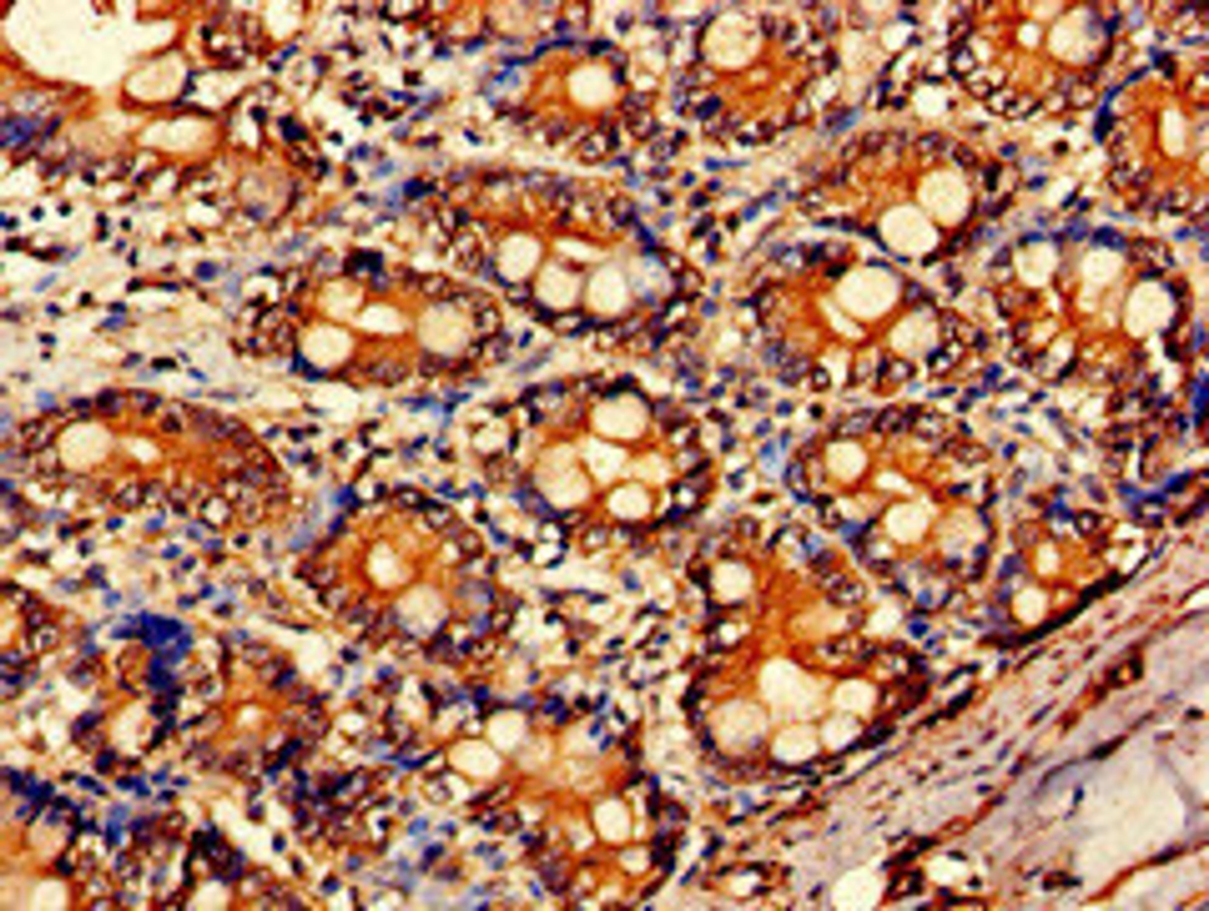 Immunohistochemistry of paraffin-embedded human small intestine tissue using CSB-PA00929A0Rb at dilution of 1:100