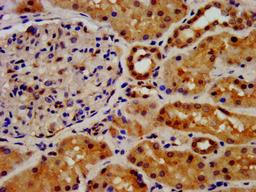 IHC image of CSB-PA008650LA01HU diluted at 1:500 and staining in paraffin-embedded human kidney tissue performed on a Leica BondTM system. After dewaxing and hydration, antigen retrieval was mediated by high pressure in a citrate buffer (pH 6.0). Section was blocked with 10% normal goat serum 30min at RT. Then primary antibody (1% BSA) was incubated at 4&deg;C overnight. The primary is detected by a biotinylated secondary antibody and visualized using an HRP conjugated SP system.