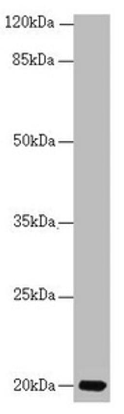 Western blot. All lanes: CETN3 antibody at 1.77 ug/ml + Mouse gonadal tissue. Secondary. Goat polyclonal to rabbit IgG at 1/10000 dilution. Predicted band size: 20 kDa. Observed band size: 20 kDa. 