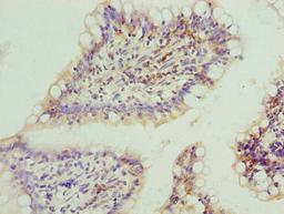 Immunohistochemistry of paraffin-embedded human small intestine tissue using CSB-PA822239LA01HU at dilution of 1:100
