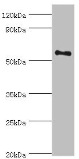Western blot. All lanes: Tyrosine-protein kinase Blk antibody at 10ug/ml + Mouse kidney tissue. Secondary. Goat polyclonal to rabbit IgG at 1/10000 dilution. Predicted band size: 58 kDa. Observed band size: 58 kDa. 