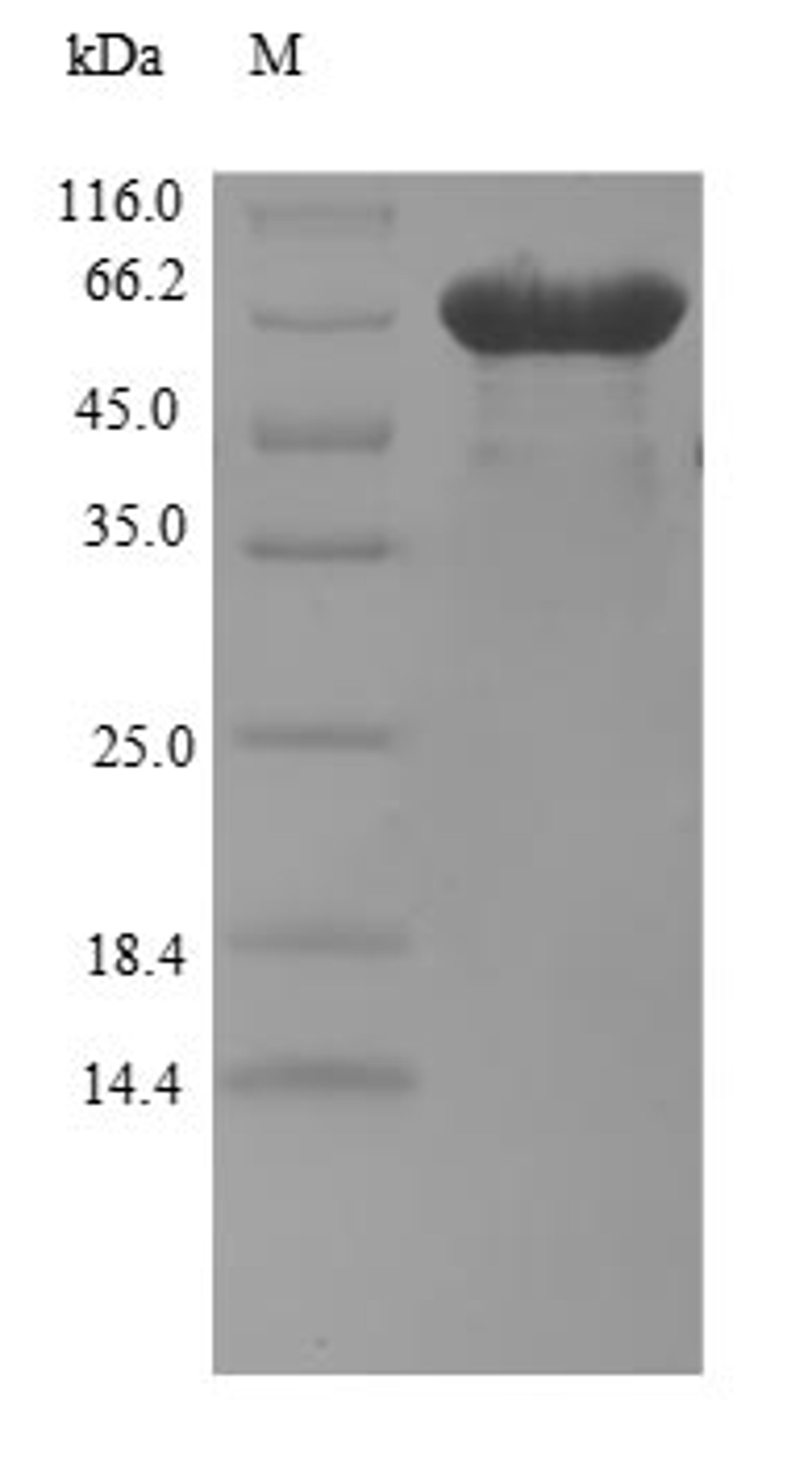 (Tris-Glycine gel) Discontinuous SDS-PAGE (reduced) with 5% enrichment gel and 15% separation gel.