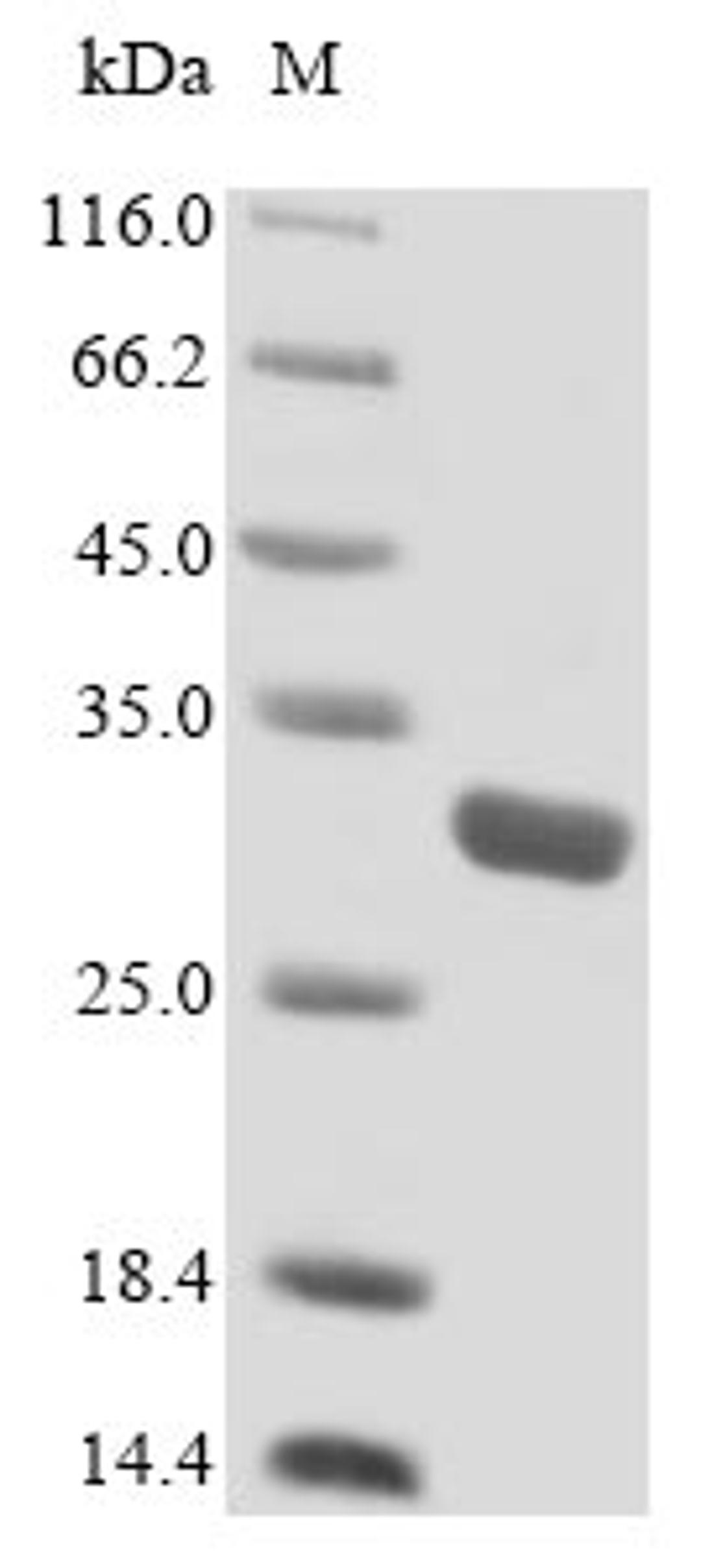 (Tris-Glycine gel) Discontinuous SDS-PAGE (reduced) with 5% enrichment gel and 15% separation gel.