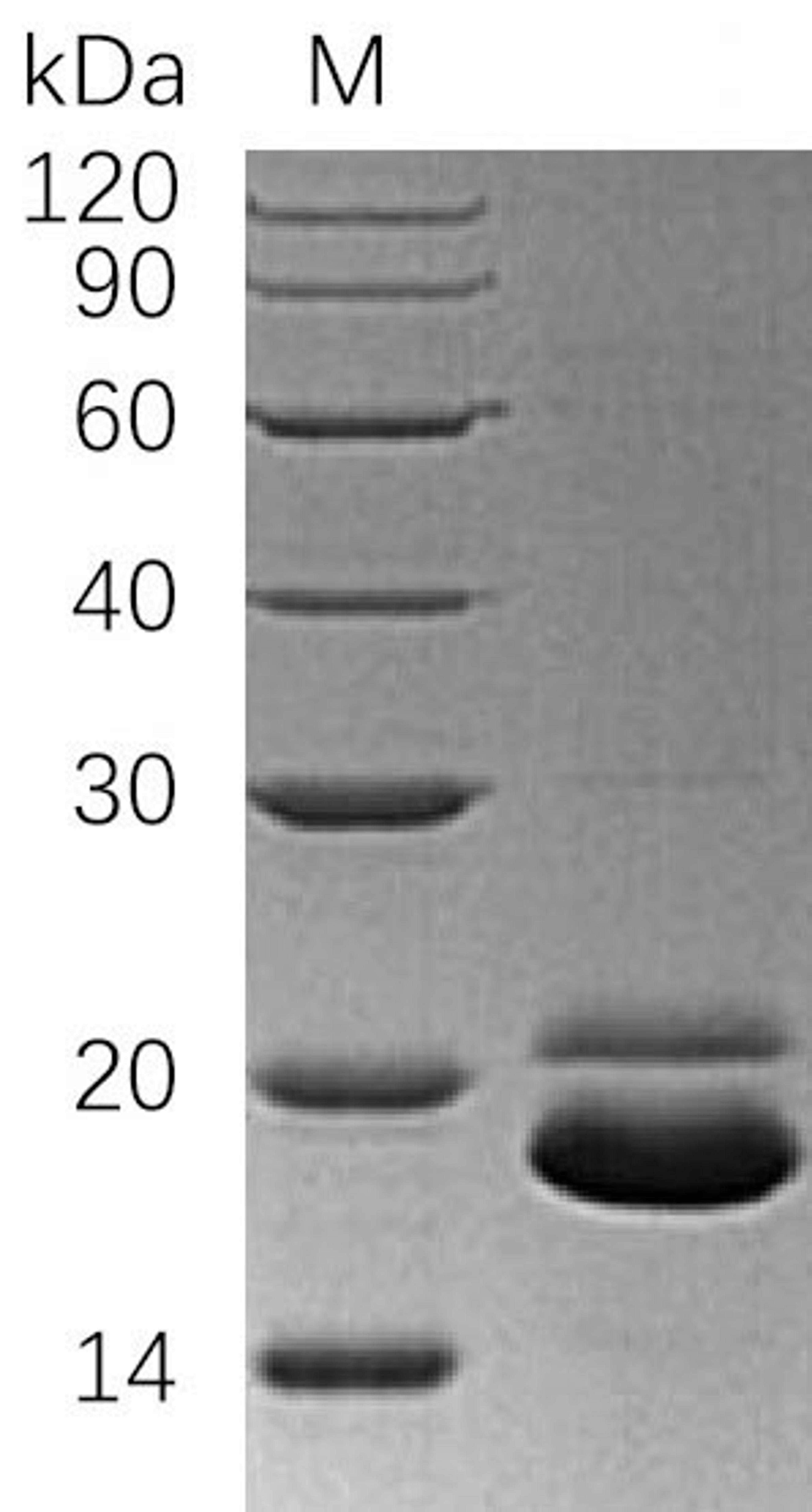 (Tris-Glycine gel) Discontinuous SDS-PAGE (reduced) with 5% enrichment gel and 15% separation gel.