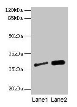 Western blot. All lanes: IGFBP1 antibody at 3µg/ml. Lane 1: A549 whole cell lysate. Lane 2: PC-3 whole cell lysate. Secondary. Goat polyclonal to rabbit IgG at 1/10000 dilution. Predicted band size: 28 kDa. Observed band size: 28 kDa