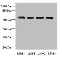 Western blot. All lanes: VANGL2 antibody at 2.26ug/ml. Lane 1: HepG2 whole cell lysate. Lane 2: MCF-7 whole cell lysate. Lane 3: Hela whole cell lysate. Lane 4: NIH/3T3 whole cell lysate. Secondary. Goat polyclonal to rabbit IgG at 1/10000 dilution. Predicted band size: 60 kDa. Observed band size: 60 kDa. 