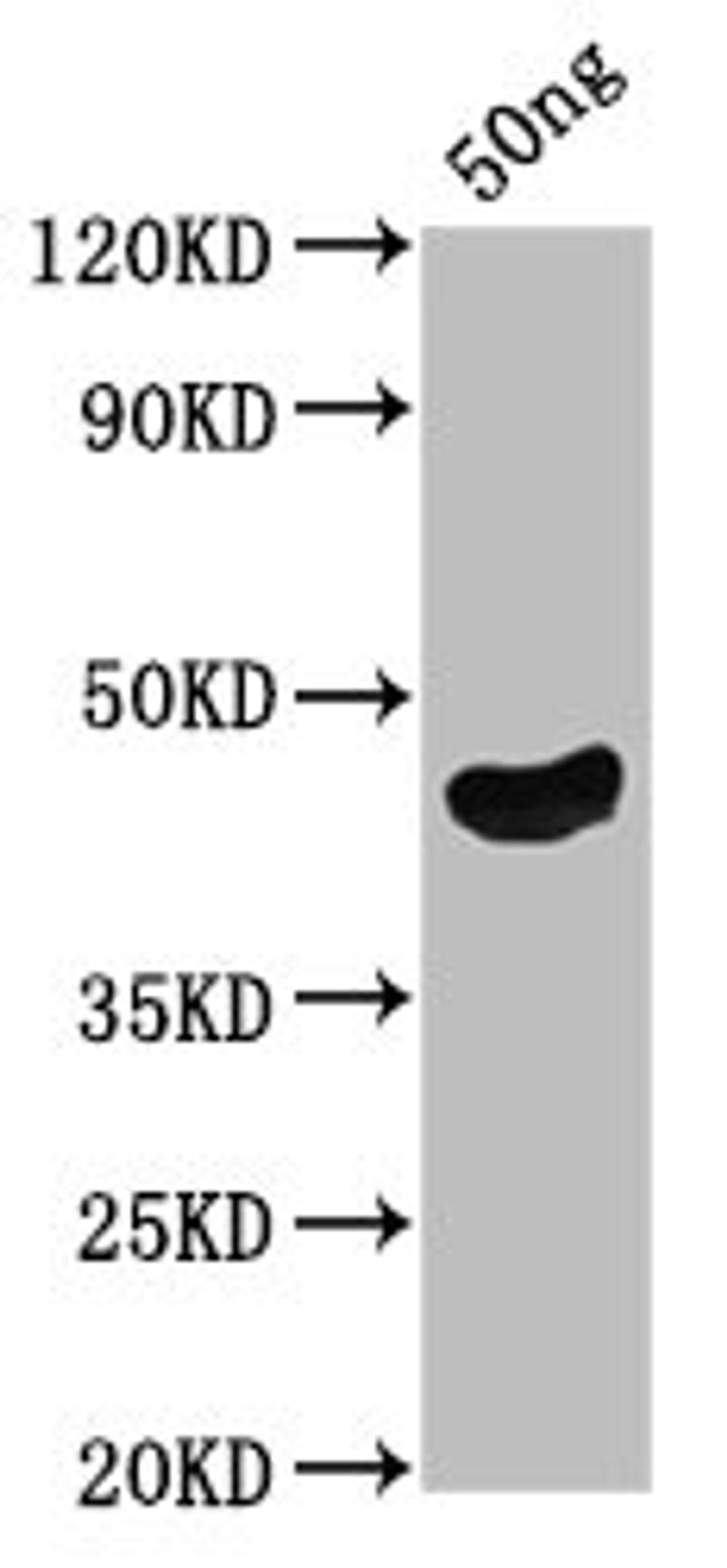 Western Blot. Positive WB detected in Recombinant protein. All lanes: oprF antibody at 5µg/ml. Secondary. Goat polyclonal to rabbit IgG at 1/50000 dilution. Predicted band size: 39.3 kDa. Observed band size: 44 kDa