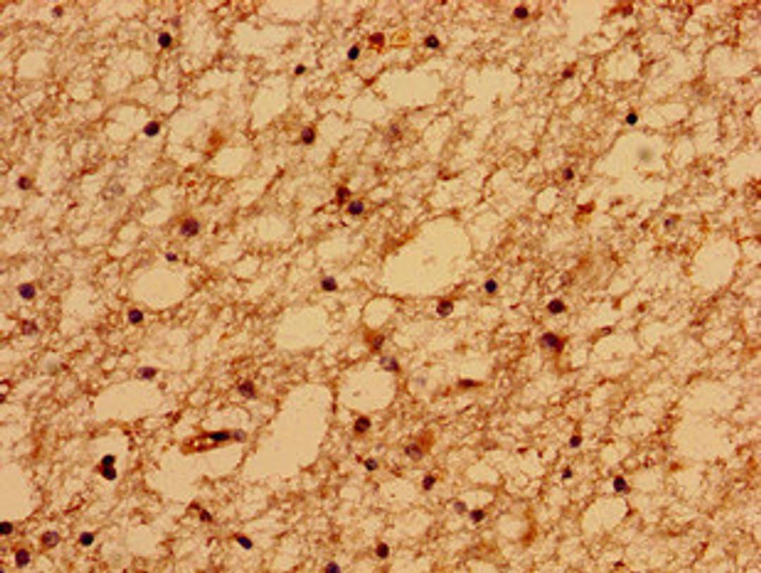 Immunohistochemistry of paraffin-embedded human brain tissue using CSB-PA689243LA01HU at dilution of 1:100