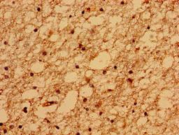 Immunohistochemistry of paraffin-embedded human brain tissue using CSB-PA689243LA01HU at dilution of 1:100