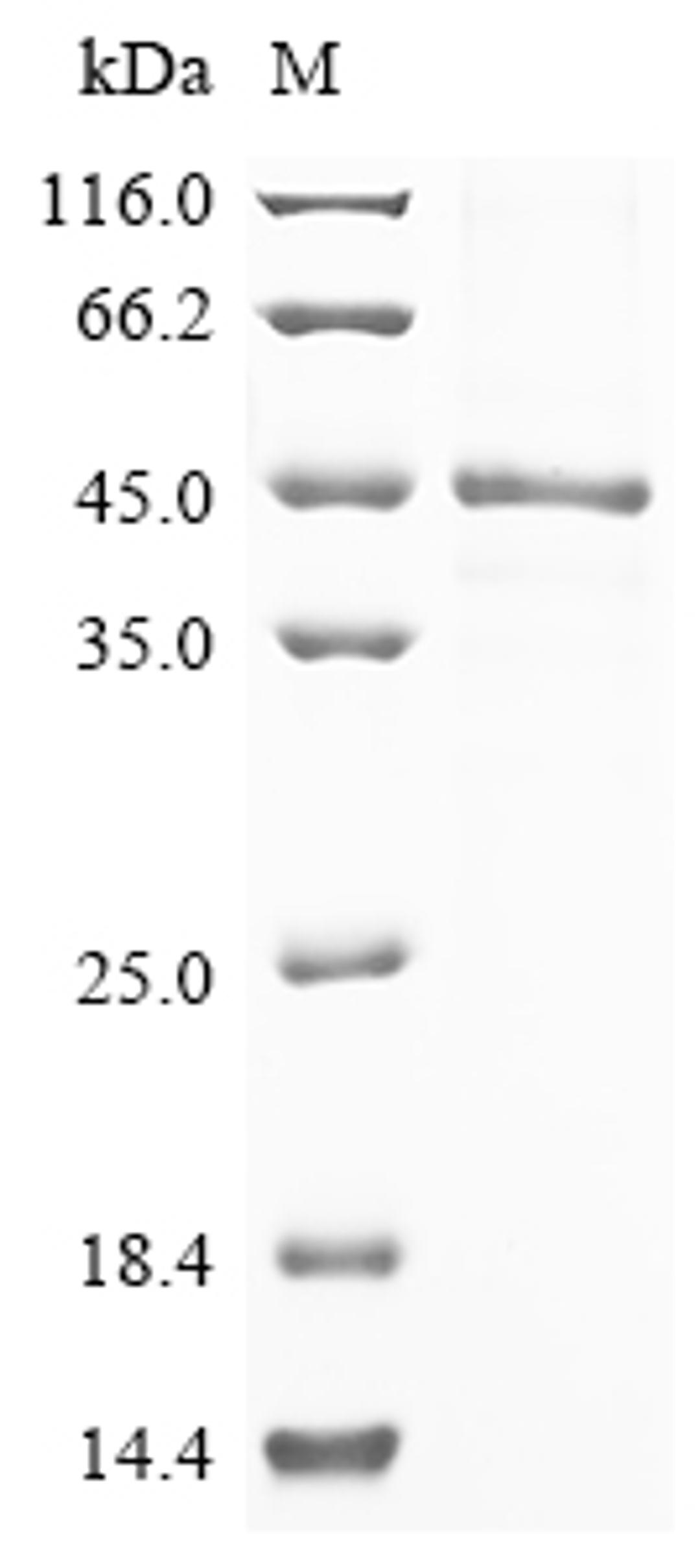 (Tris-Glycine gel) Discontinuous SDS-PAGE (reduced) with 5% enrichment gel and 15% separation gel.