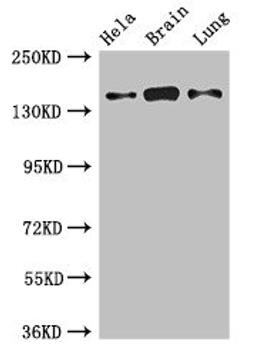 Western Blot. Positive WB detected in: Hela whole cell lysate, Mouse brain tissue, Rat lung tissue. All lanes: SULF2 antibody at 2.7ug/ml. Secondary. Goat polyclonal to rabbit IgG at 1/50000 dilution. Predicted band size: 101 kDa. Observed band size: 140 kDa. 
