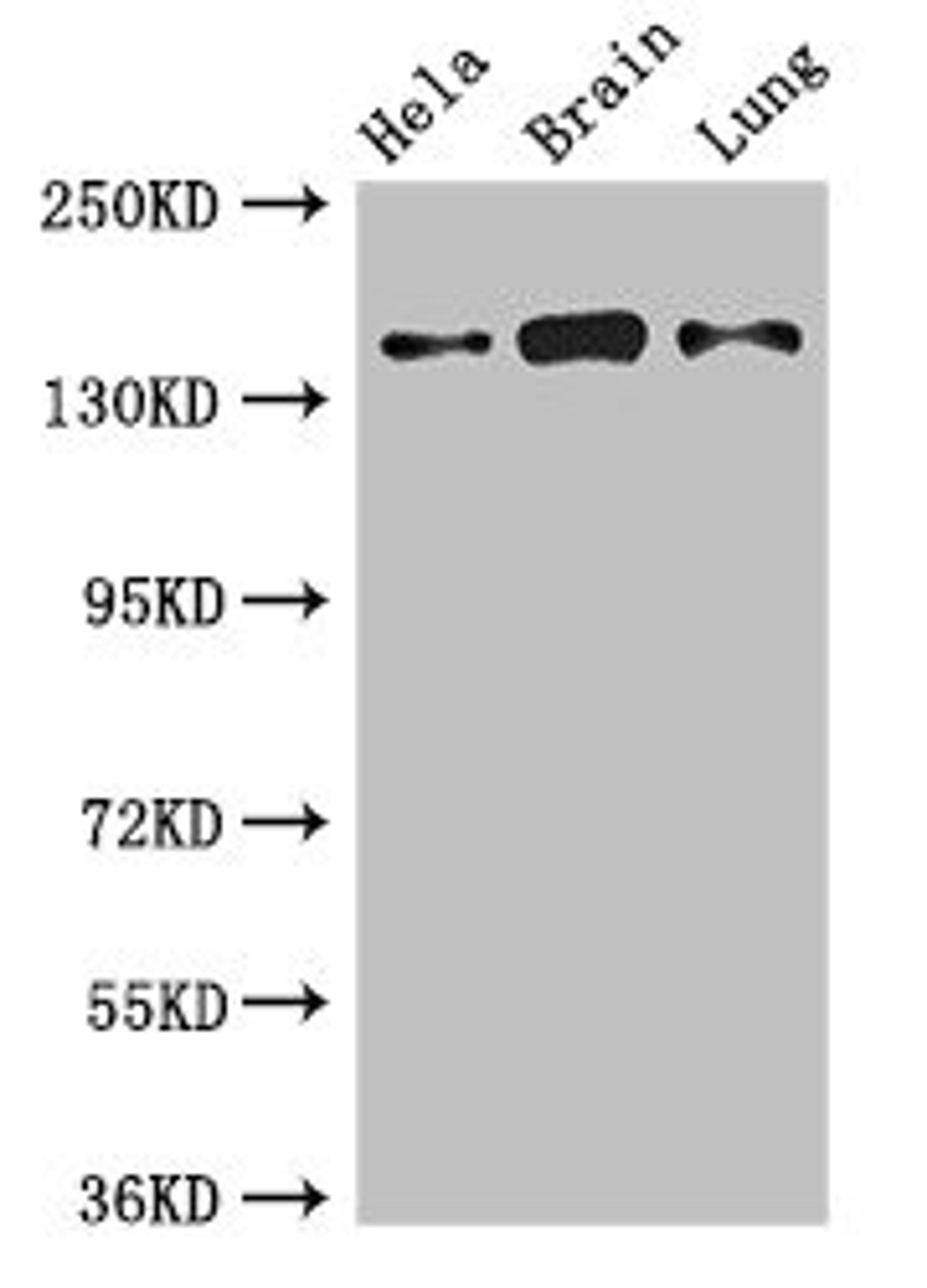 Western Blot. Positive WB detected in: Hela whole cell lysate, Mouse brain tissue, Rat lung tissue. All lanes: SULF2 antibody at 2.7ug/ml. Secondary. Goat polyclonal to rabbit IgG at 1/50000 dilution. Predicted band size: 101 kDa. Observed band size: 140 kDa. 