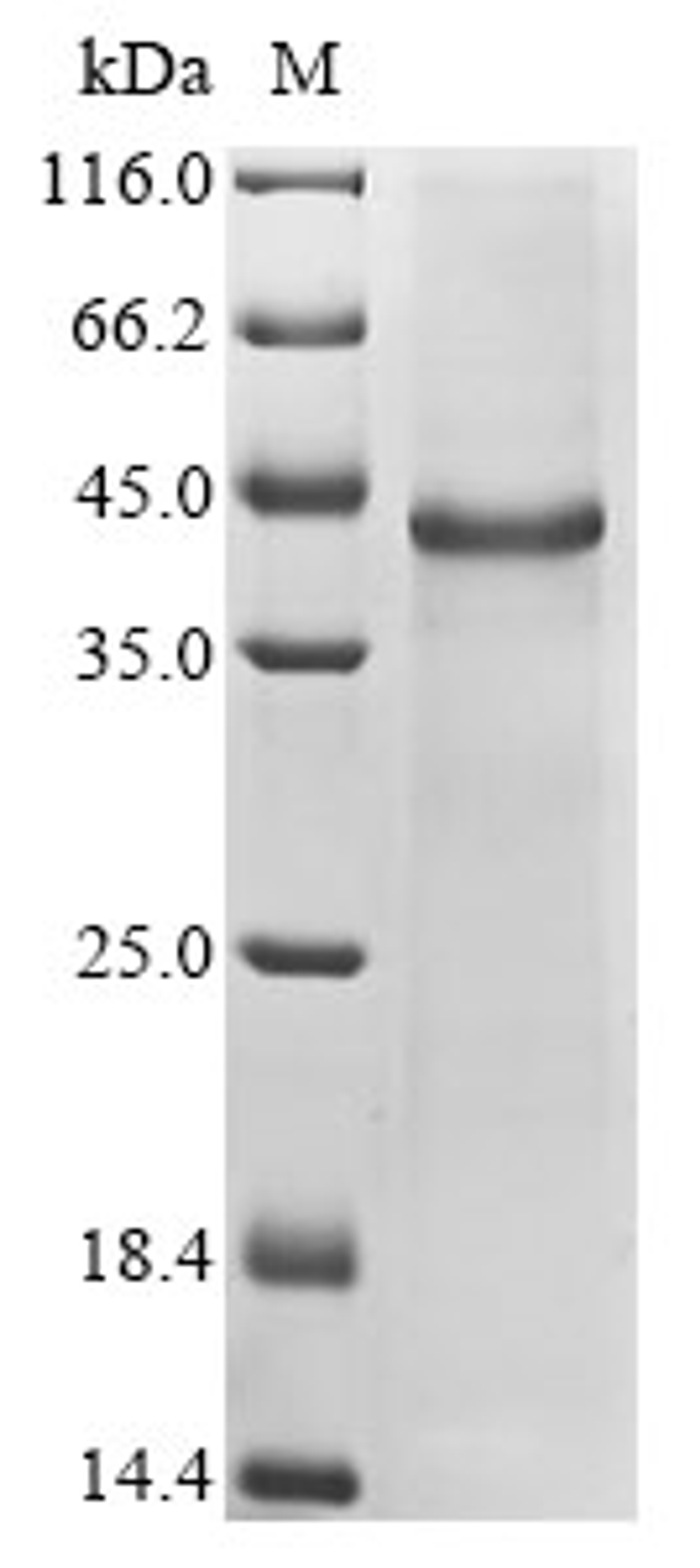 (Tris-Glycine gel) Discontinuous SDS-PAGE (reduced) with 5% enrichment gel and 15% separation gel.