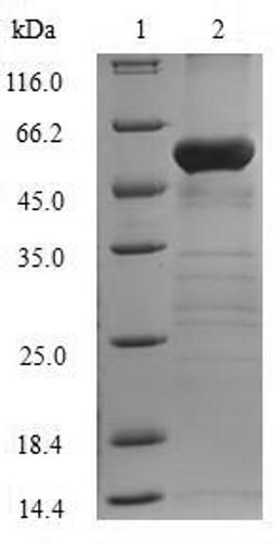 (Tris-Glycine gel) Discontinuous SDS-PAGE (reduced) with 5% enrichment gel and 15% separation gel.