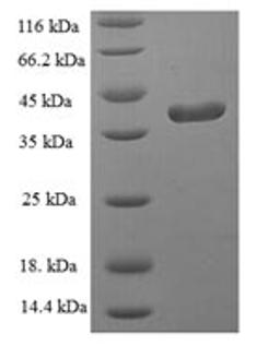 (Tris-Glycine gel) Discontinuous SDS-PAGE (reduced) with 5% enrichment gel and 15% separation gel.