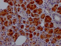 IHC image of CSB-RA950380A0HU diluted at 1:100 and staining in paraffin-embedded human salivary gland tissue performed on a Leica BondTM system. After dewaxing and hydration, antigen retrieval was mediated by high pressure in a citrate buffer (pH 6.0). Section was blocked with 10% normal goat serum 30min at RT. Then primary antibody (1% BSA) was incubated at 4℃ overnight. The primary is detected by a Goat anti-rabbit IgG polymer labeled by HRP and visualized using 0.05% DAB.