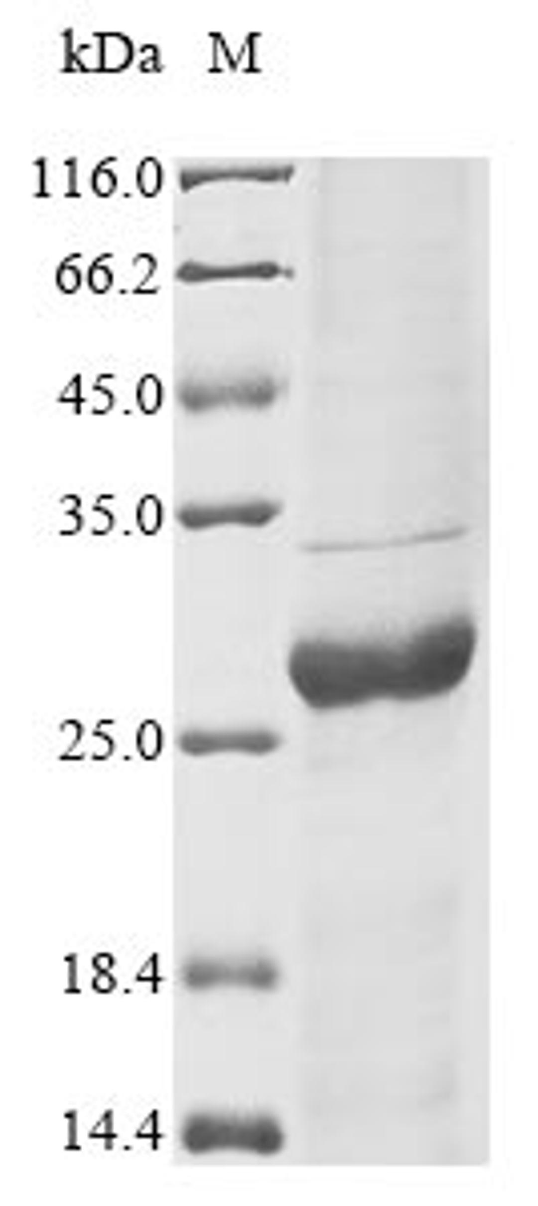 (Tris-Glycine gel) Discontinuous SDS-PAGE (reduced) with 5% enrichment gel and 15% separation gel.