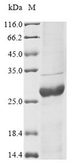 (Tris-Glycine gel) Discontinuous SDS-PAGE (reduced) with 5% enrichment gel and 15% separation gel.