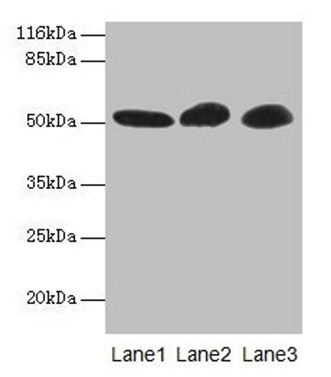 Western blot. All lanes: GDI2 antibody at 2µg/ml. Lane 1: Mouse brain tissue. Lane 2: HepG2 whole cell lysate. Lane 3: MCF-7 whole cell lysate. Secondary. Goat polyclonal to rabbit IgG at 1/10000 dilution. Predicted band size: 51, 46 kDa. Observed band size: 51 kDa