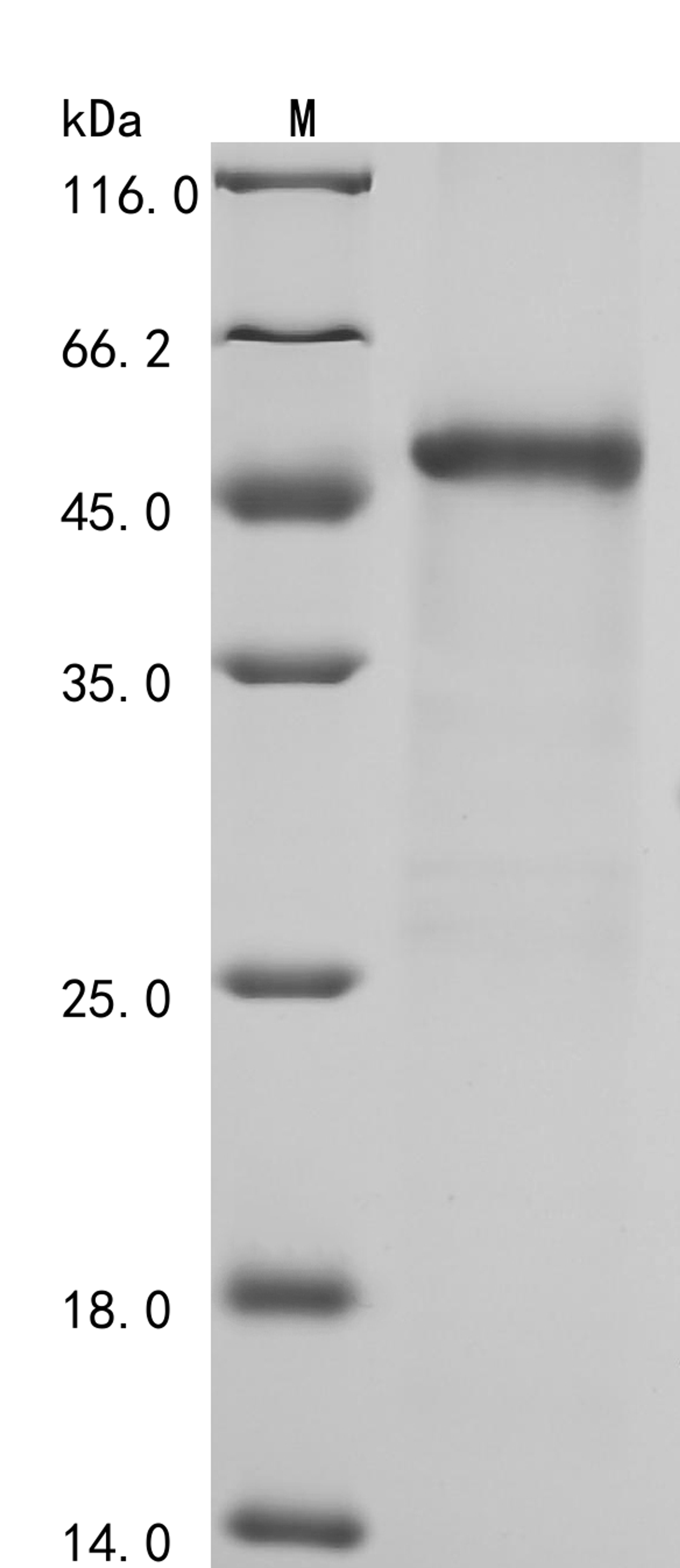 (Tris-Glycine gel) Discontinuous SDS-PAGE (reduced) with 5% enrichment gel and 15% separation gel.