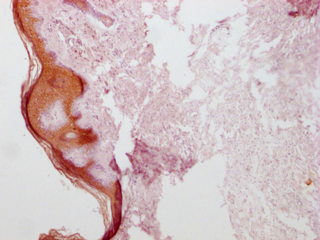 IHC image of CSB-MA555839 diluted at 1:100 and staining in paraffin-embedded human skin tissue performed on a Leica BondTM system. After dewaxing and hydration, antigen retrieval was mediated by high pressure in a citrate buffer (pH 6.0). Section was blocked with 10% normal goat serum 30min at RT. Then primary antibody (1% BSA) was incubated at 4°C overnight. The primary is detected by a Goat anti-mouse IgG polymer labeled by HRP and visualized using 0.05% DAB.