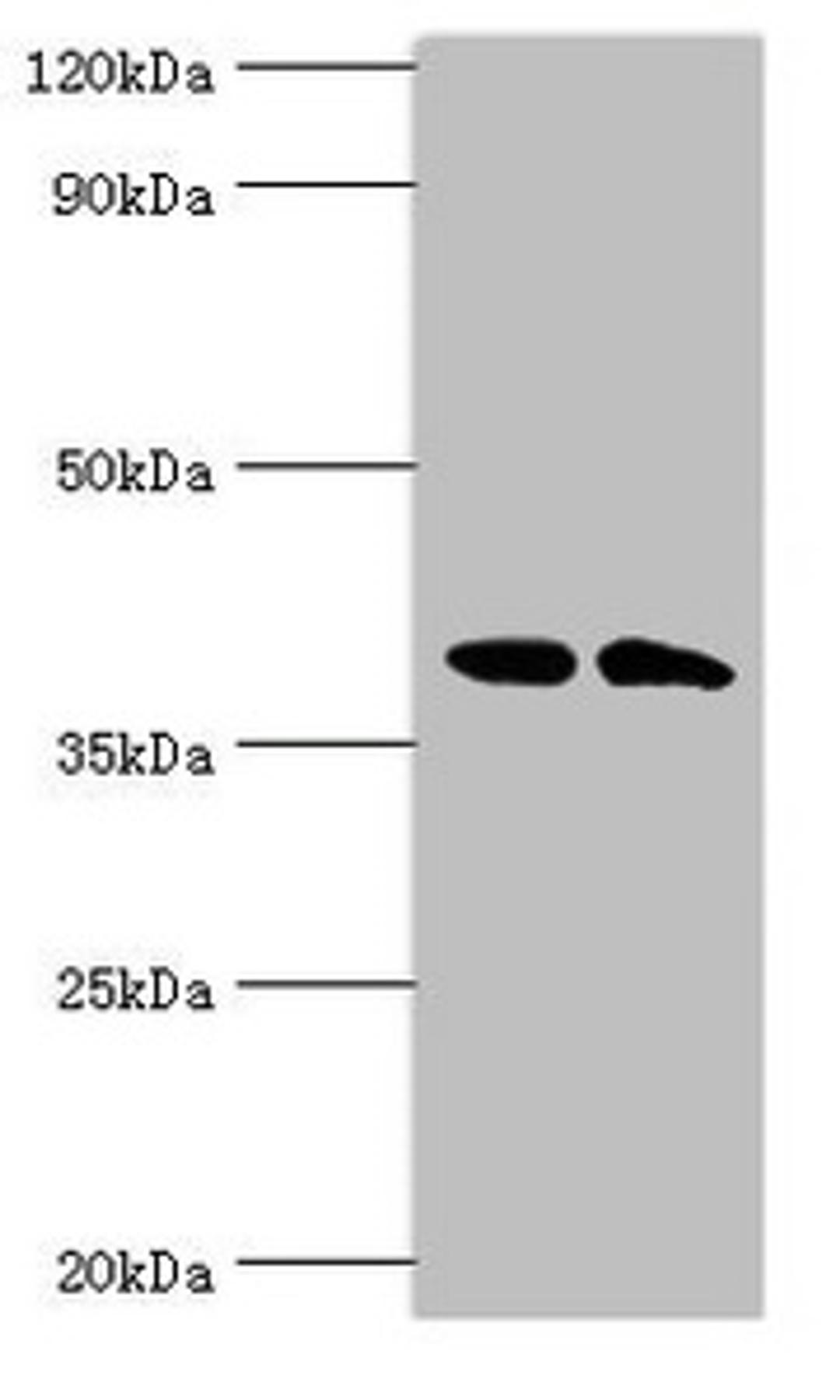 Western blot. All lanes: Casein kinase I isoform alpha-like antibody at 4ug/ml. Lane 1: K562 whole cell lysate. Lane 2: Hela whole cell lysate. Secondary. Goat polyclonal to rabbit IgG at 1/10000 dilution. Predicted band size: 39 kDa. Observed band size: 39 kDa. 