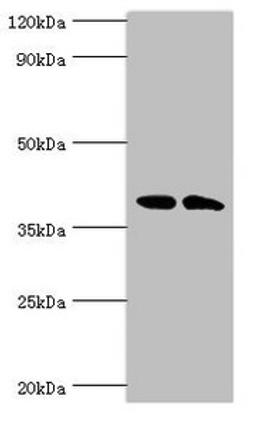 Western blot. All lanes: Casein kinase I isoform alpha-like antibody at 4ug/ml. Lane 1: K562 whole cell lysate. Lane 2: Hela whole cell lysate. Secondary. Goat polyclonal to rabbit IgG at 1/10000 dilution. Predicted band size: 39 kDa. Observed band size: 39 kDa. 
