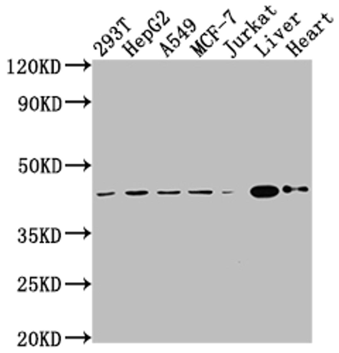Western Blot. Positive WB detected in: 293T whole cell lysate, HepG2 whole cell lysate, A549 whole cell lysate, MCF-7 whole cell lysate, Jurkat whole cell lysate, Mouse liver tissue, Mouse heart tissue. All lanes: AGTR2 antibody at 1:2000. Secondary. Goat polyclonal to rabbit IgG at 1/50000 dilution. Predicted band size: 42 kDa. Observed band size: 42 kDa. 