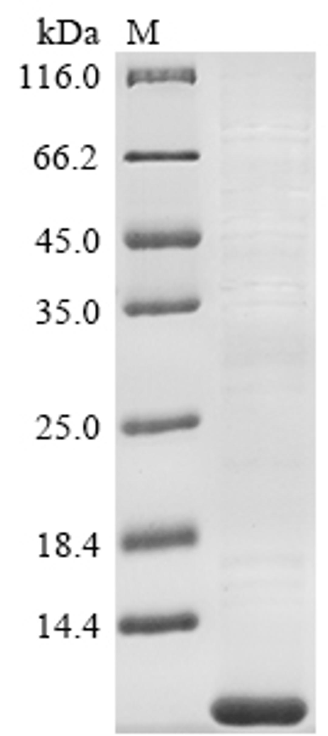 (Tris-Glycine gel) Discontinuous SDS-PAGE (reduced) with 5% enrichment gel and 15% separation gel.