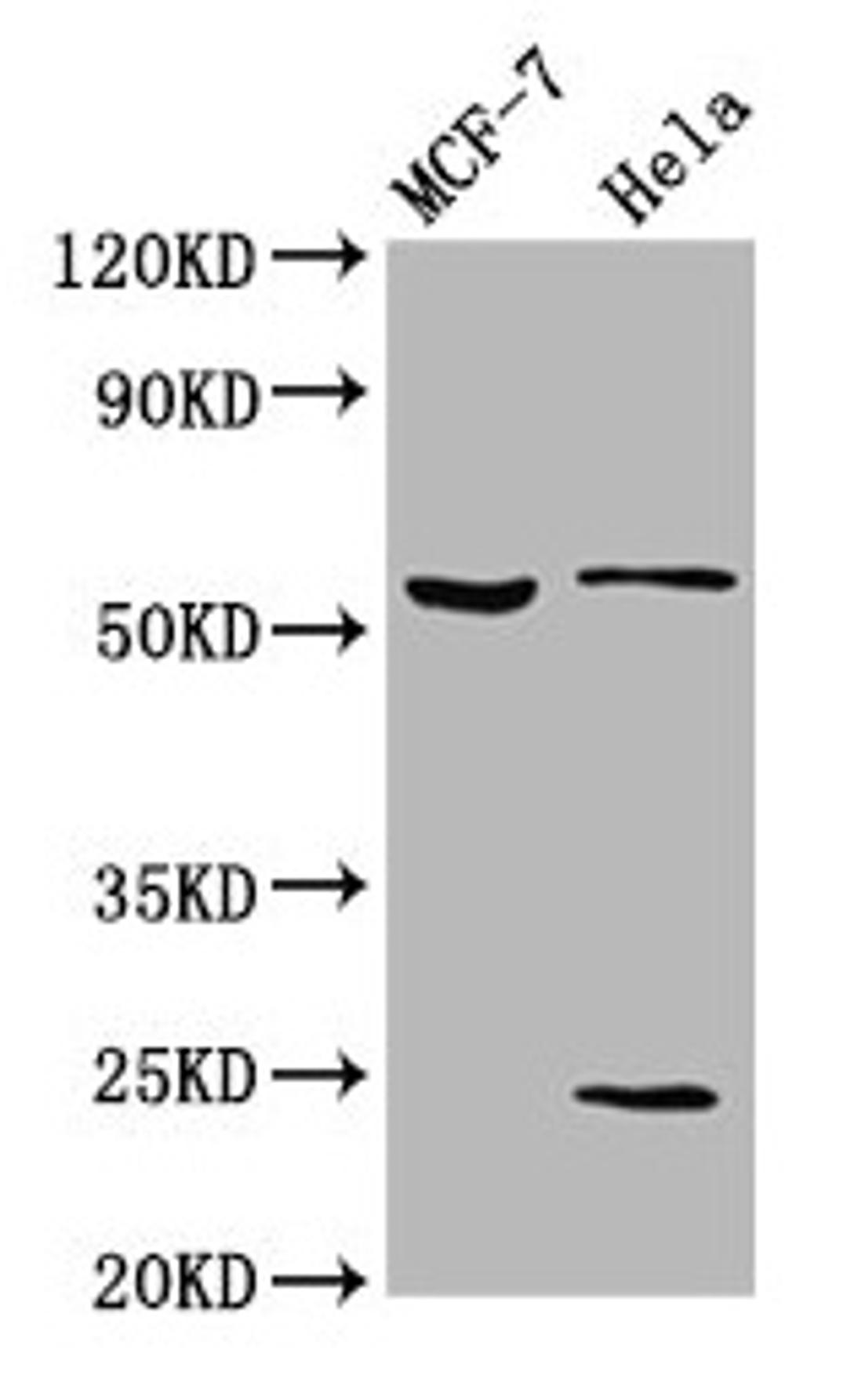 Western Blot. Positive WB detected in: MCF-7 whole cell lysate, Hela whole cell lysate. All lanes: SLC45A2 antibody at 5.3µg/ml. Secondary. Goat polyclonal to rabbit IgG at 1/50000 dilution. Predicted band size: 59, 34, 52 kDa. Observed band size: 59 kDa