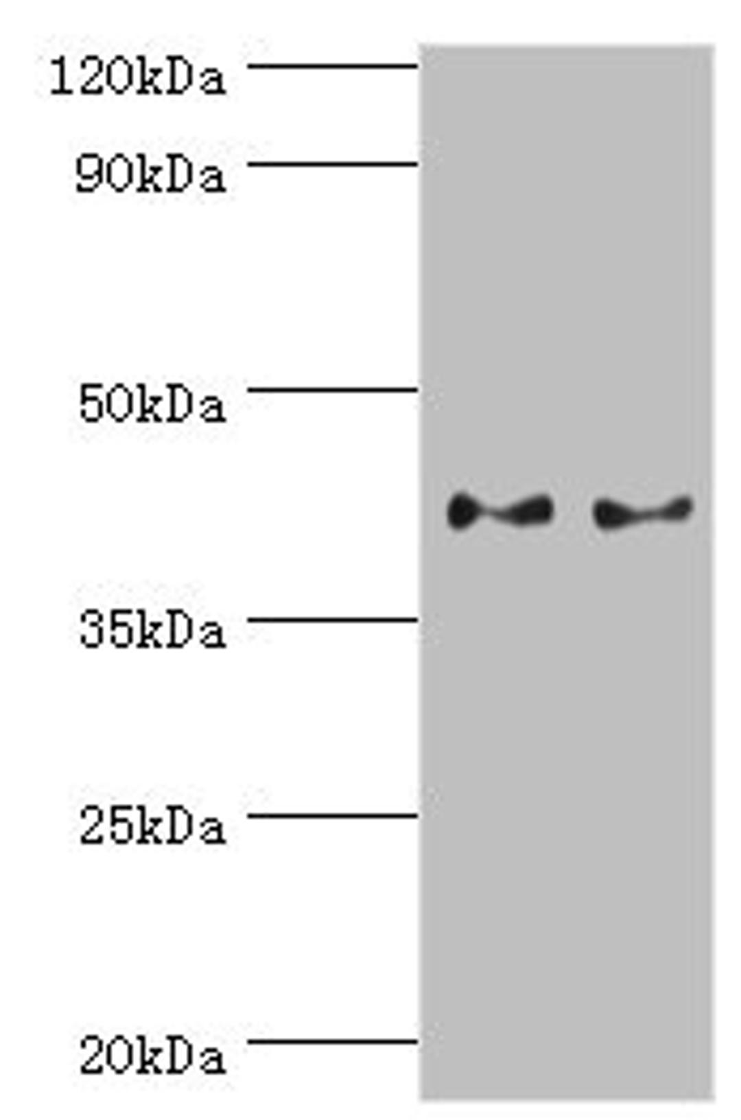 Western blot. All lanes: Serpin B5 antibody at 2ug/ml. Lane 1: HepG2 whole cell lysate. Lane 2: A431 whole cell lysate. Secondary. Goat polyclonal to rabbit IgG at 1/10000 dilution. Predicted band size: 43, 26 kDa. Observed band size: 43 kDa. 