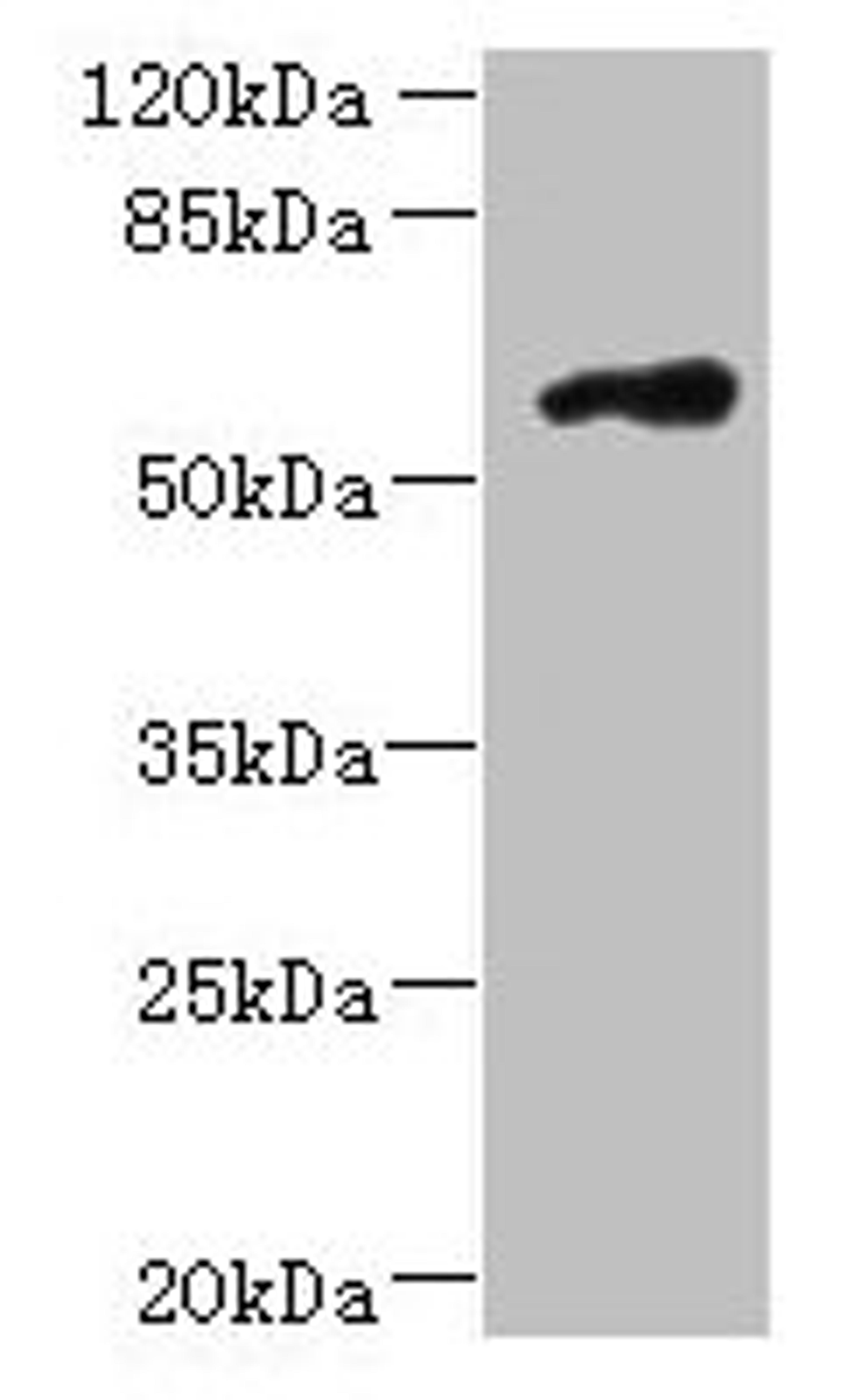 Western blot. All lanes: FAM126B antibody at 7µg/ml + A431 whole cell lysate. Secondary. Goat polyclonal to rabbit IgG at 1/10000 dilution. Predicted band size: 59 kDa. Observed band size: 59 kDa