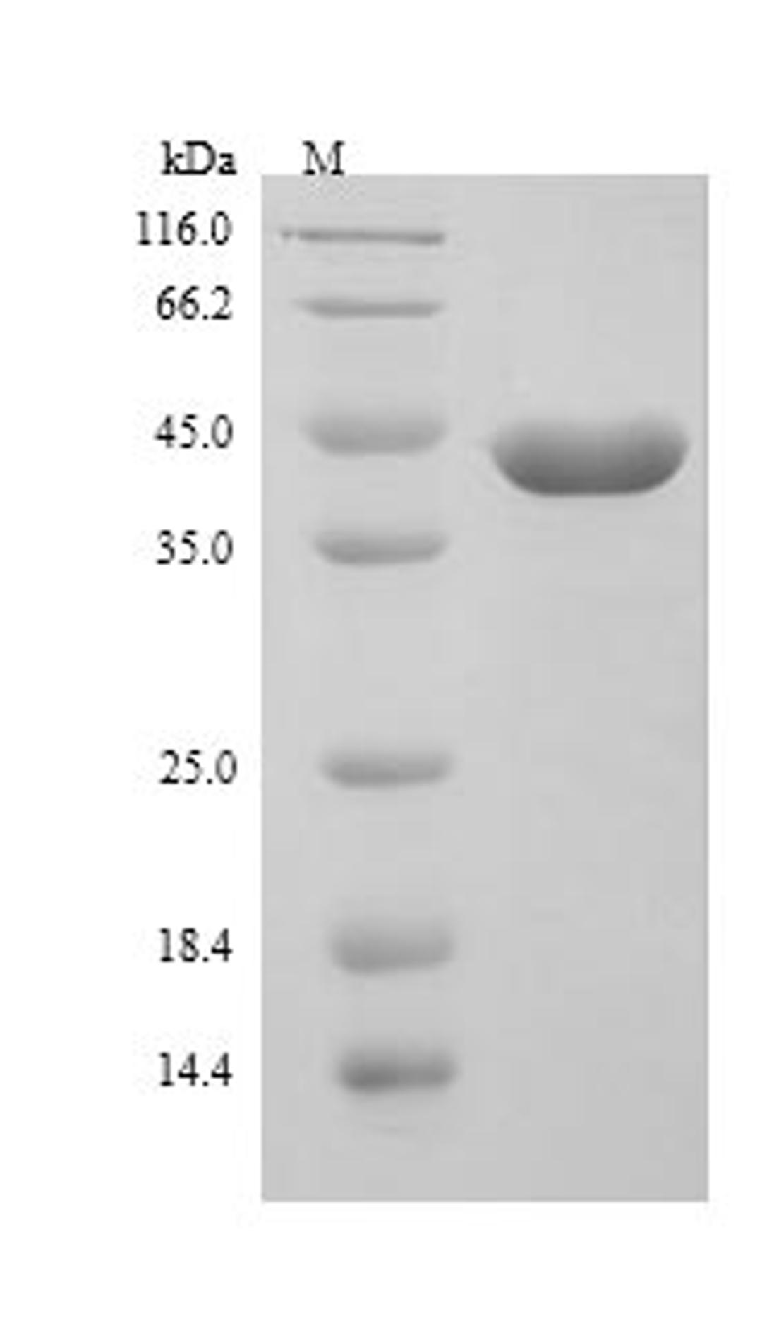 (Tris-Glycine gel) Discontinuous SDS-PAGE (reduced) with 5% enrichment gel and 15% separation gel.