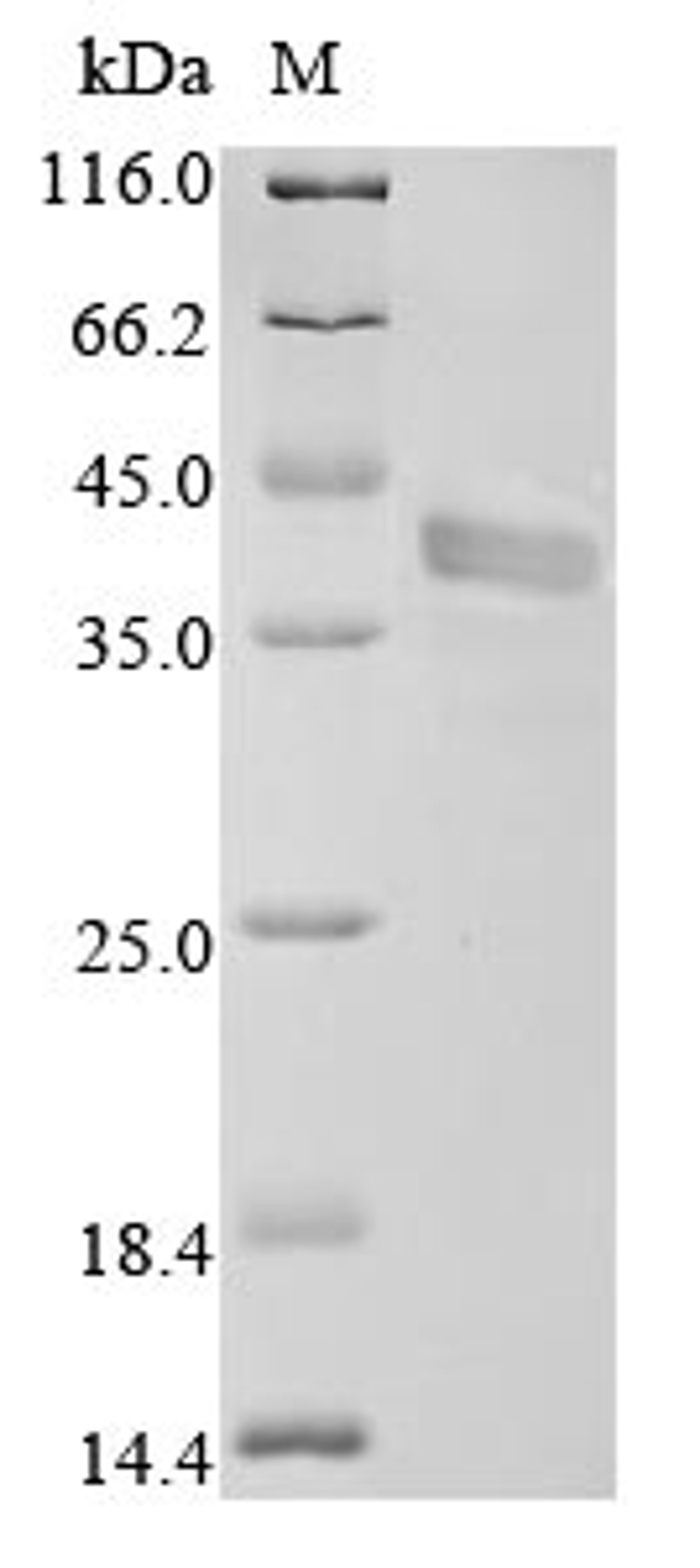 (Tris-Glycine gel) Discontinuous SDS-PAGE (reduced) with 5% enrichment gel and 15% separation gel.