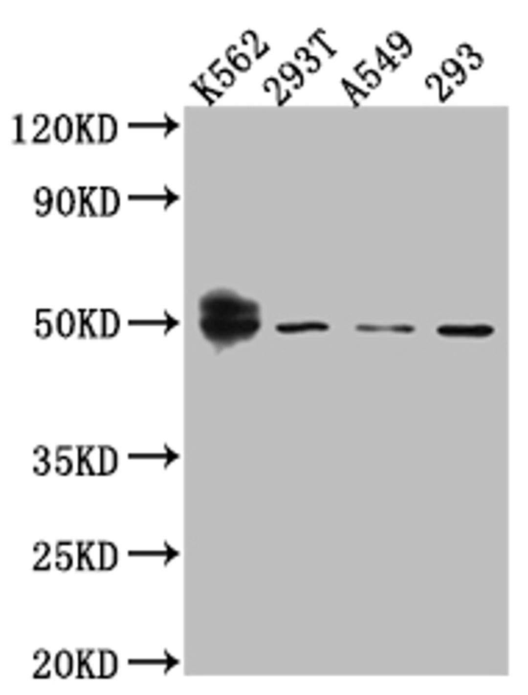 Western Blot. Positive WB detected in: K562 whole cell lysate, 293T whole cell lysate, A549 whole cell lysate, HEK293 whole cell lysate. All lanes: Wilms Tumor Protein antibody at 1:1000. Secondary. Goat polyclonal to rabbit IgG at 1/50000 dilution. Predicted band size: 50, 48, 48, 49, 35, 57, 56, 34 kDa. Observed band size: 50 kDa. 