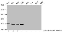 Western Blot. Detected samples: Hela whole cell lysate, 293 whole cell lysate, A549 whole cell lysate, K562 whole cell lysate; Untreated (-) or treated (+) with 30mM sodium butyrate for 4h. All lanes: HIST1H3A antibody at 1:2000. Secondary. Goat polyclonal to rabbit IgG at 1/40000 dilution. Predicted band size: 16 kDa. Observed band size: 16 kDa
