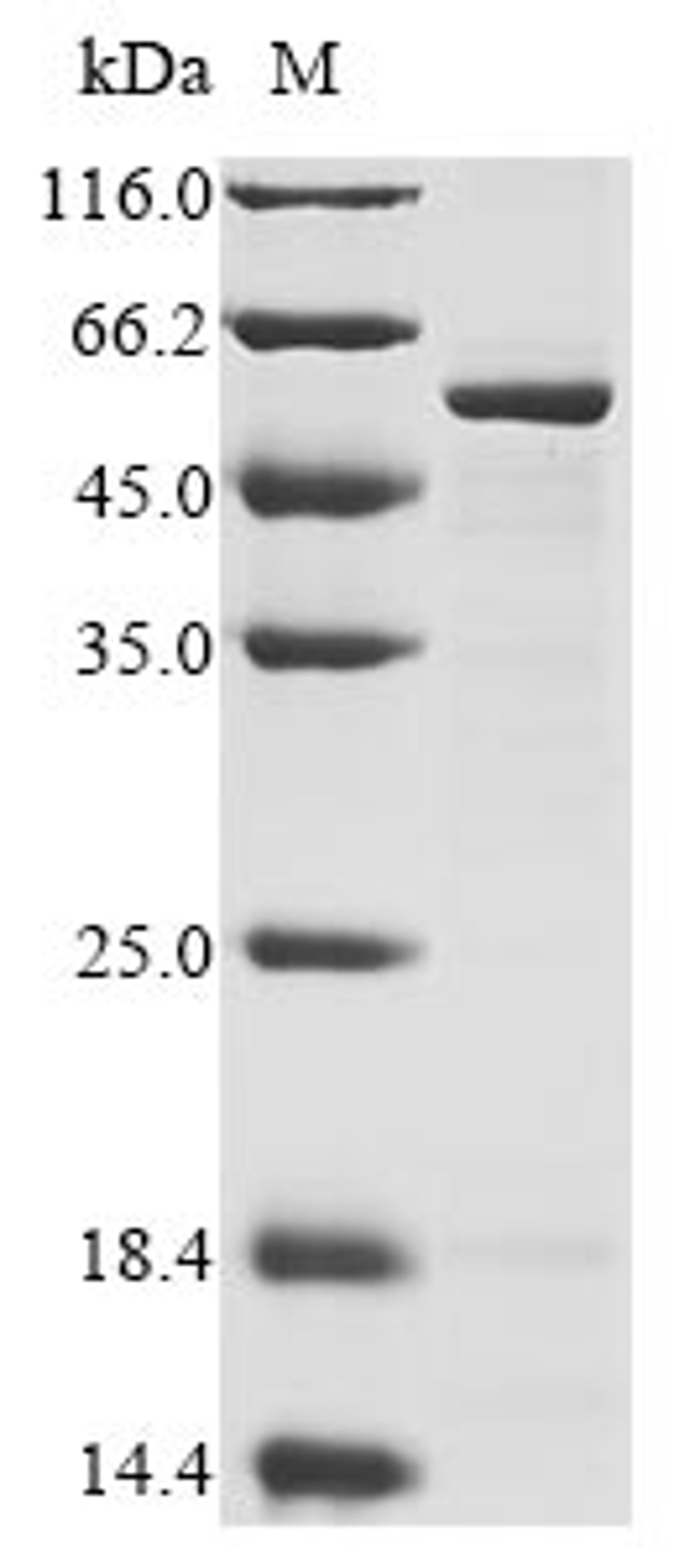 (Tris-Glycine gel) Discontinuous SDS-PAGE (reduced) with 5% enrichment gel and 15% separation gel.