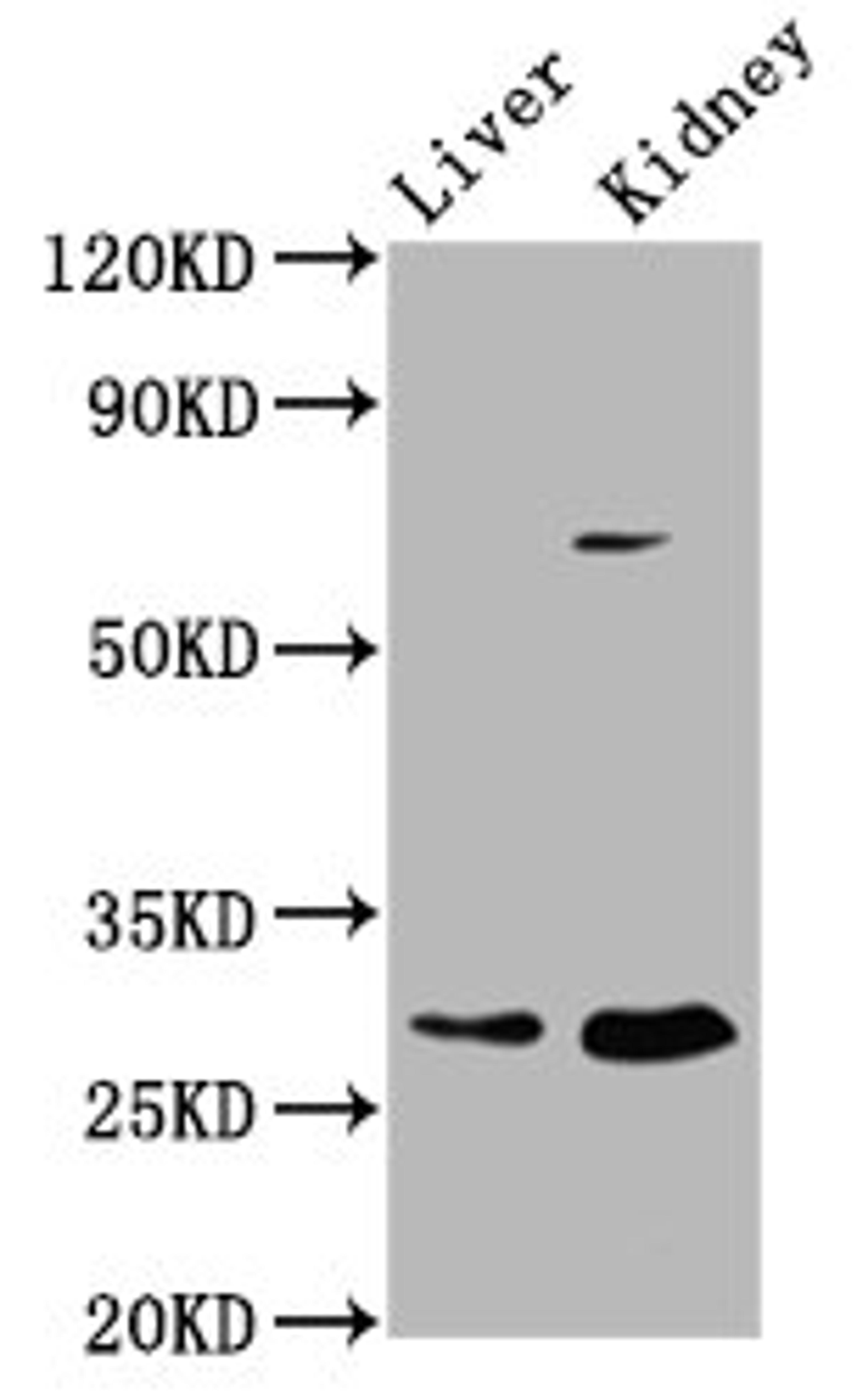 Western Blot. Positive WB detected in: Rat liver tissue, Rat kidney tissue. All lanes: PEX11A antibody at 2.37ug/ml. Secondary. Goat polyclonal to rabbit IgG at 1/50000 dilution. Predicted band size: 29, 25 kDa. Observed band size: 29 kDa. 